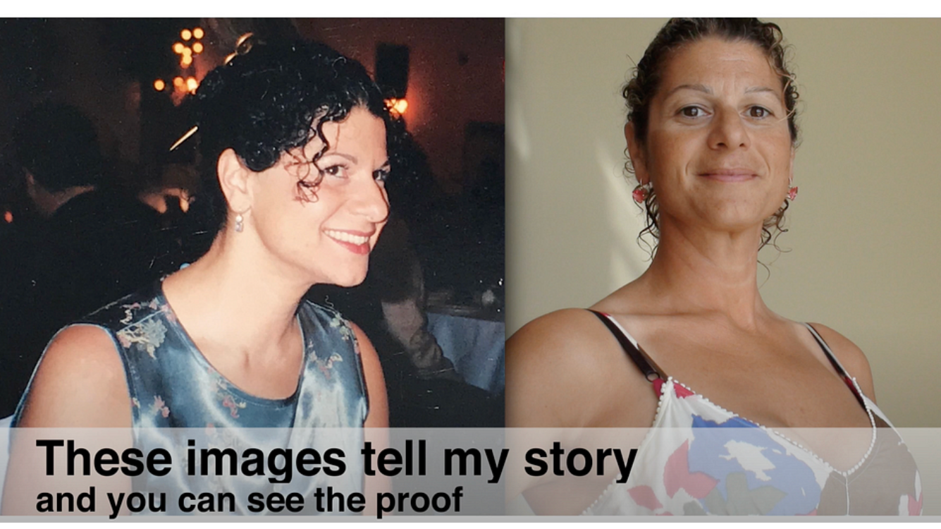 My Personal Posture Journey Growing Up with Poor Posture and Low Self Esteem