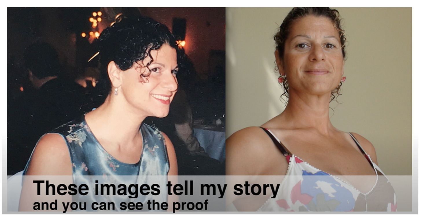 My Personal Posture Journey Growing Up with Poor Posture and Low Self Esteem